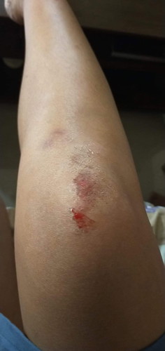 natipalok pero d nka heels
