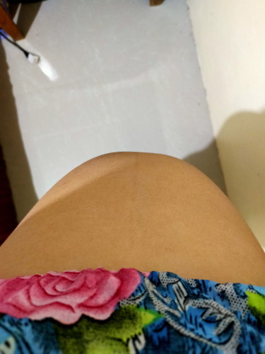 2nd Trimester
