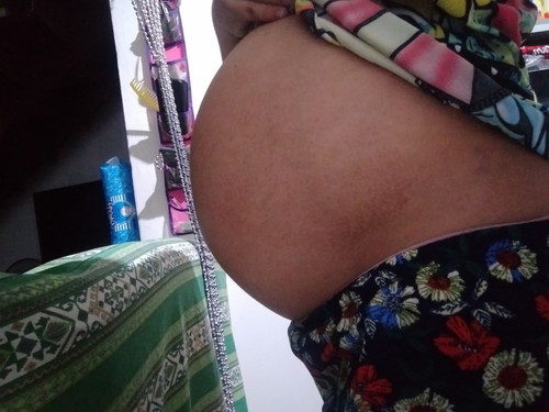 36 weeks and 1day