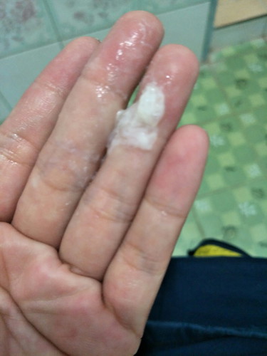 34+1มีมูกใสขุ่น