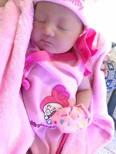 หลังจากคลอดได้3วันน้องมีอาการตัวเหลือง10.5
