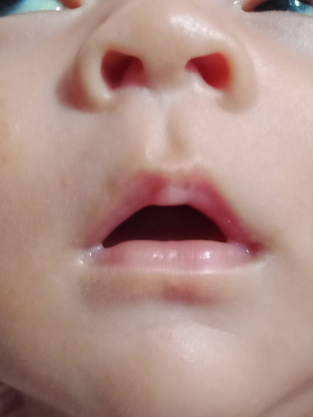 น้องปากพองค่ะ