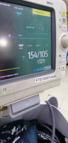 Tekanan Darah Tinggi Selepas Bersalin