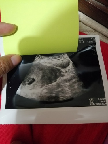 ประจำเดือนครั้งสุดท้าย4พ.ย