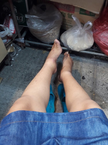 เท้าบวม