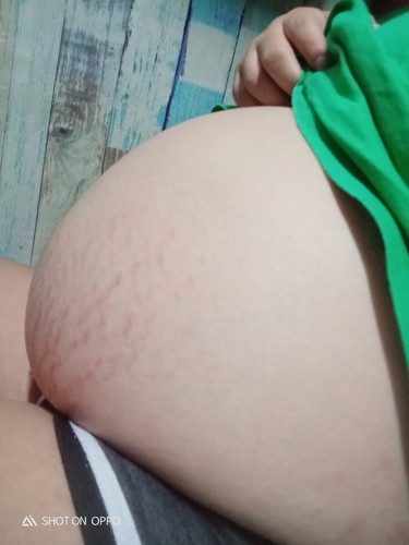 Malaki Po Ba?