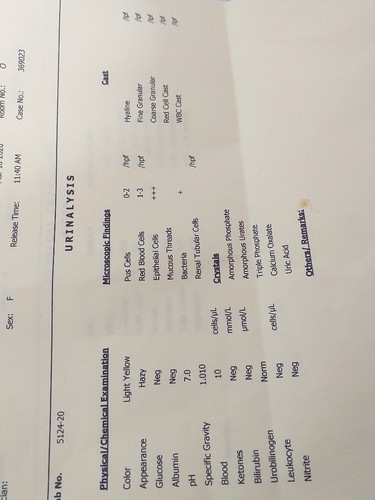 URINALYSIS RESULT