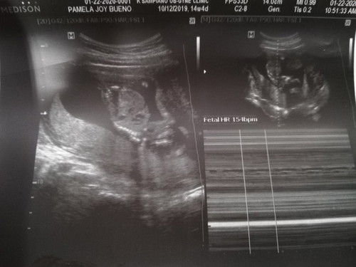 slightly open cervix