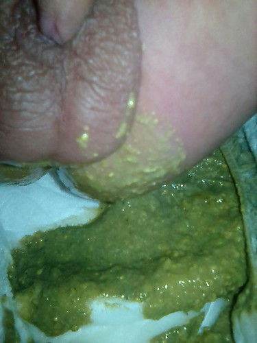 poop