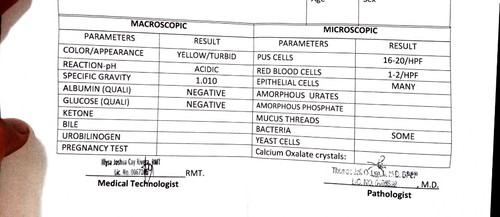 Urinalysis Result