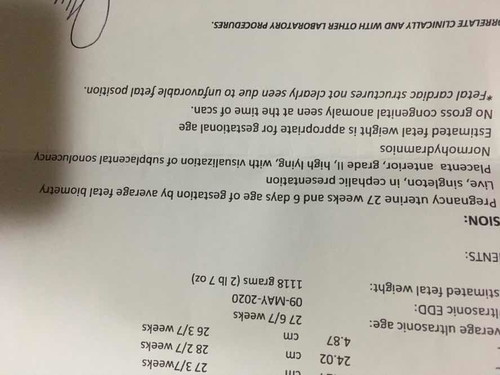 asking for an advice