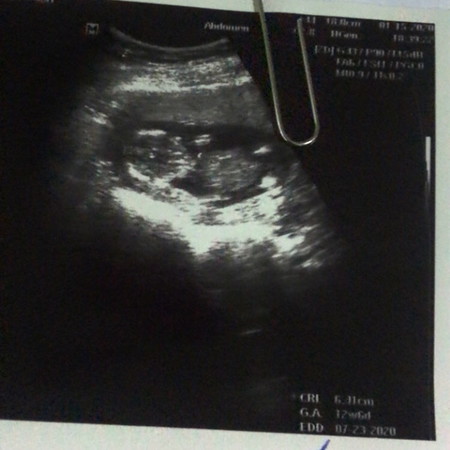 13 Weeks✌?