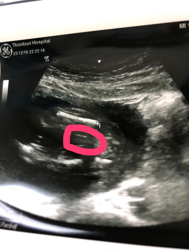 18 w