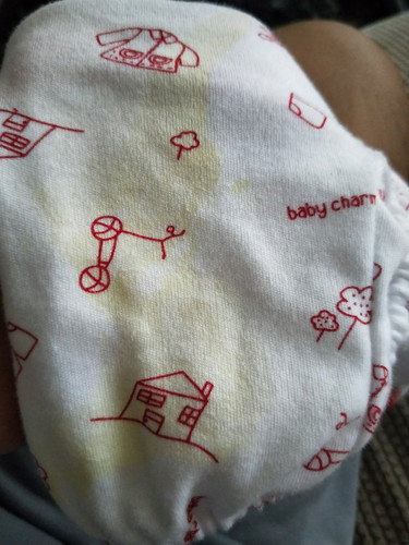 Yellow vomit Newborn