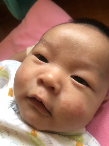 น้องเป็นอะไรค่ะ