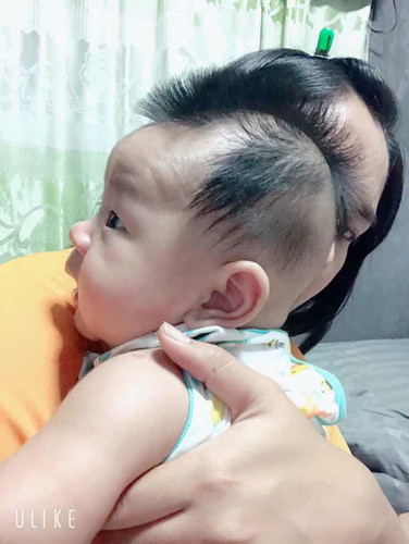 น้องจะหัวแบนไหมค่ะ