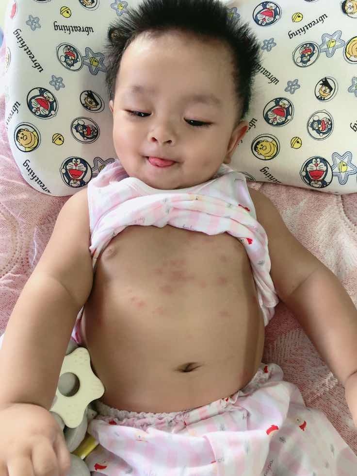 น้องไปฉีดวัคซีนเข็มที่สามมา