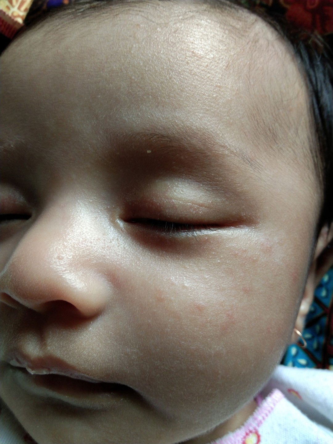 Kulit baby 1 1/2 bln merintis