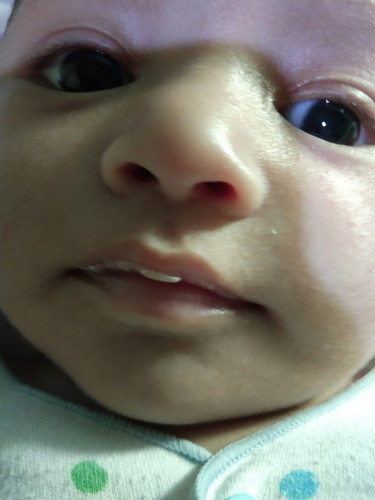 Bibir baby umur 2 bulan