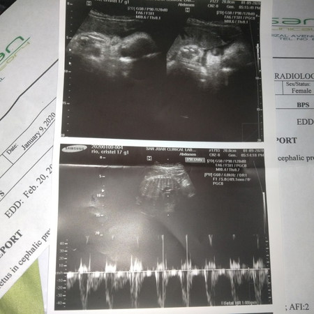 35 weeks?? Ang gulo.