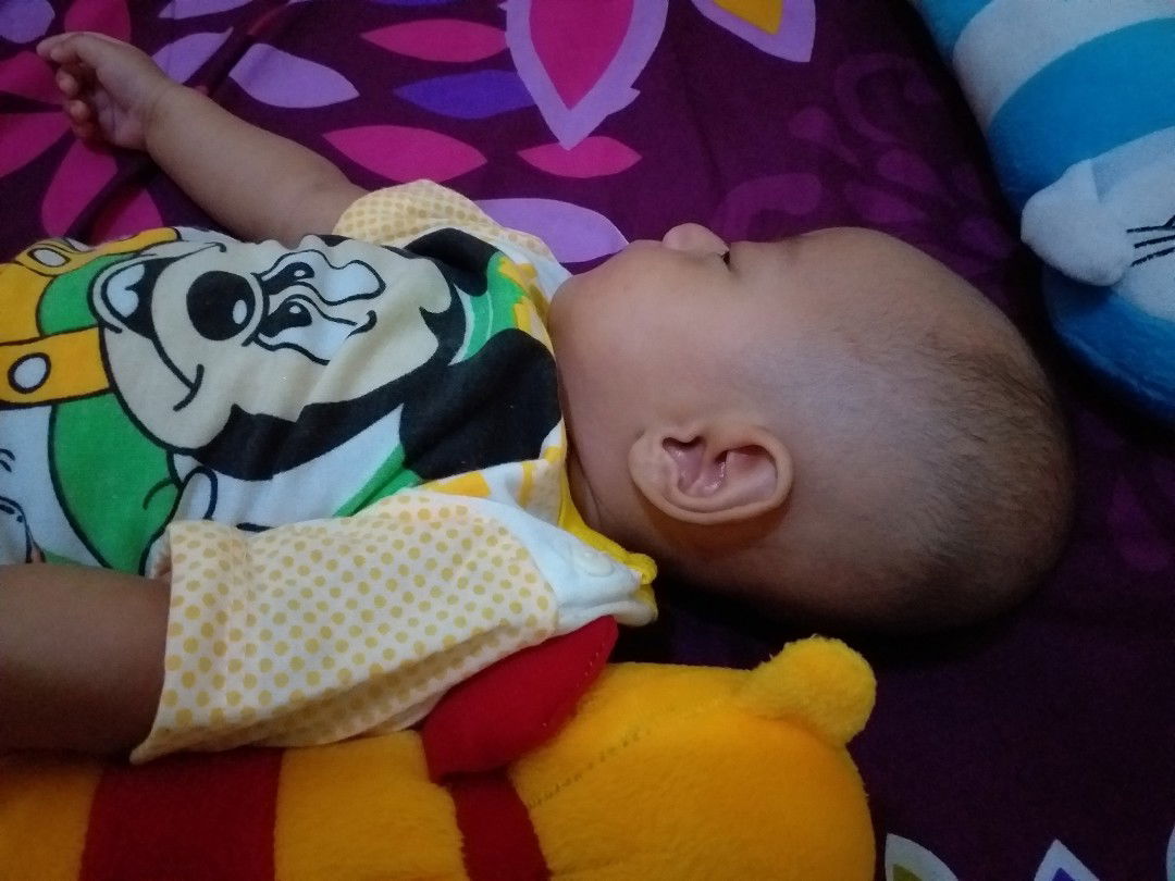 kepala bayi