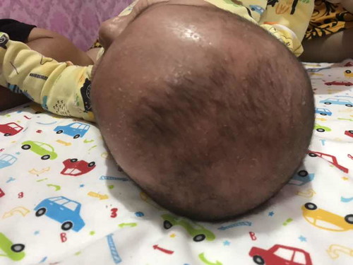 bun mau nanya ini kenapa ya kepala anak ku:(