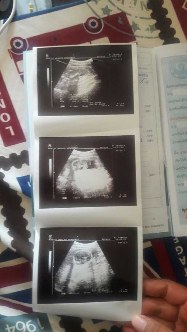 Supalup Ray profile icon