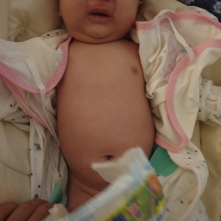 baby tummy