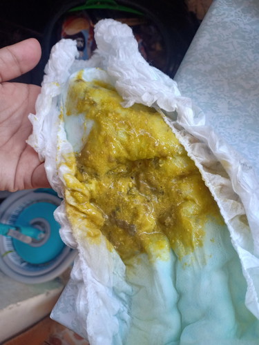 baby poop (formula fed)