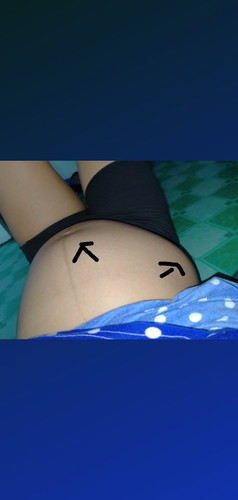 bukol