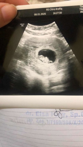 9 weeks