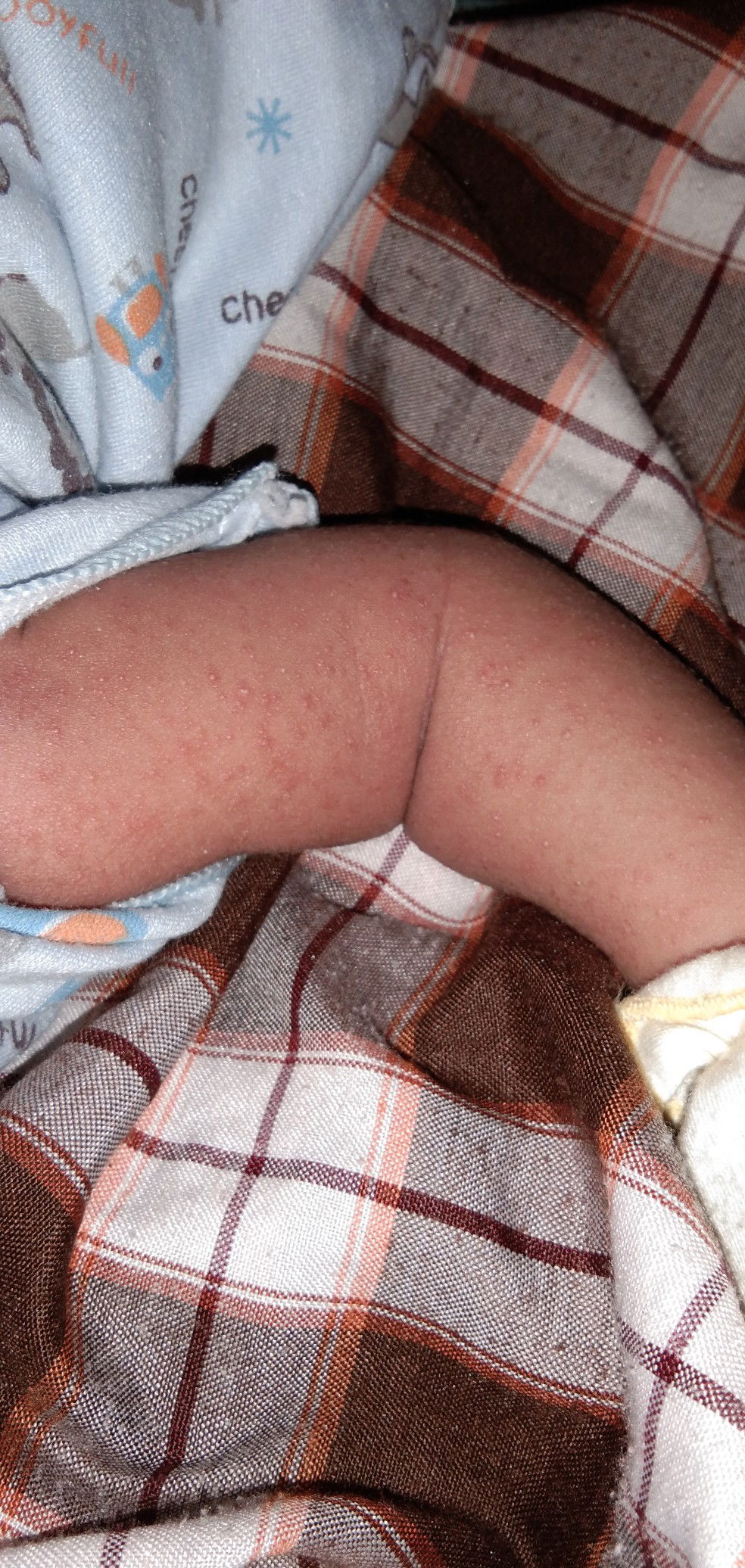 bintik bintik merah di tangan dan bdan leher