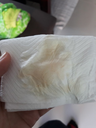 แบบนี้อันตรายมั้ยคะ ก่อนหน้าไปหาหมอมา คุณหมอฉีดยากันแท้งให้เมื่อ 27 พ.ย ที่ผ่านมาค่ะ แล้วก็เข้าห้องน้ำเมื่อเช้าตอนตื่นนอนก็แบบนี้เลยค่ะ แต่ตอนนี้ไม่มีเลือดออกแล้ว(ไม่ปวดท้อง) แบบนี้น่ากังวลมั้ยคะ?