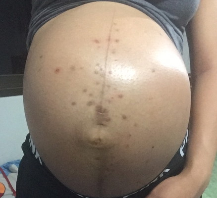 มีใครเป็นบ้าง?