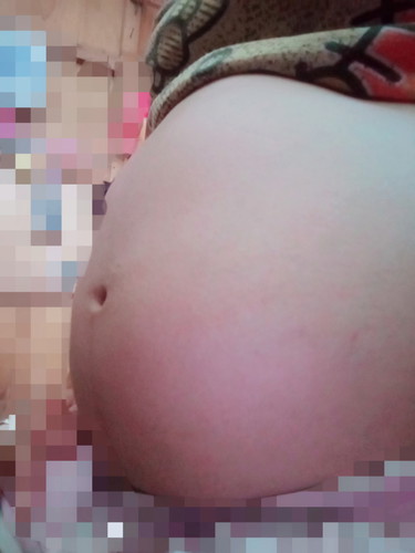 baby bumps