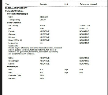 URINALYSIS