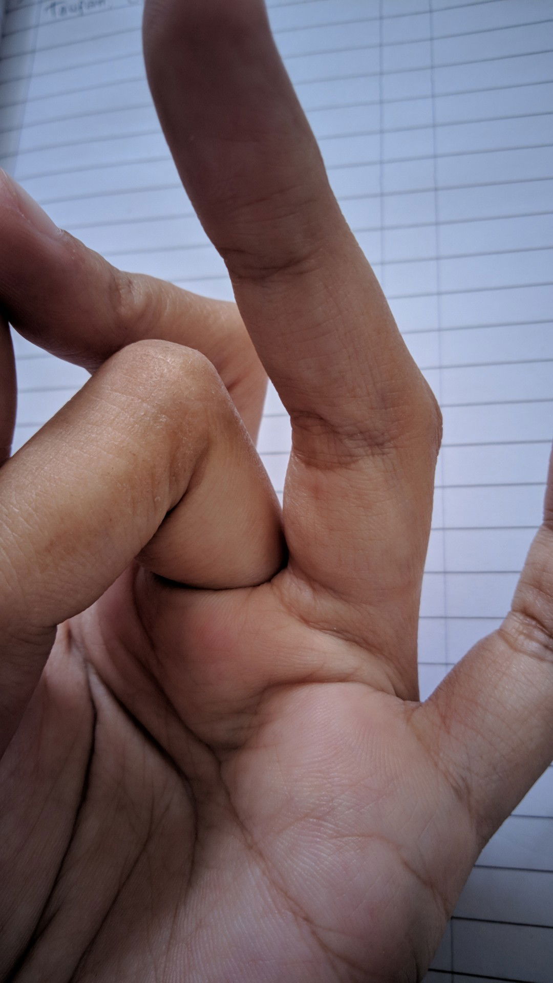 kuli gatal dan kering