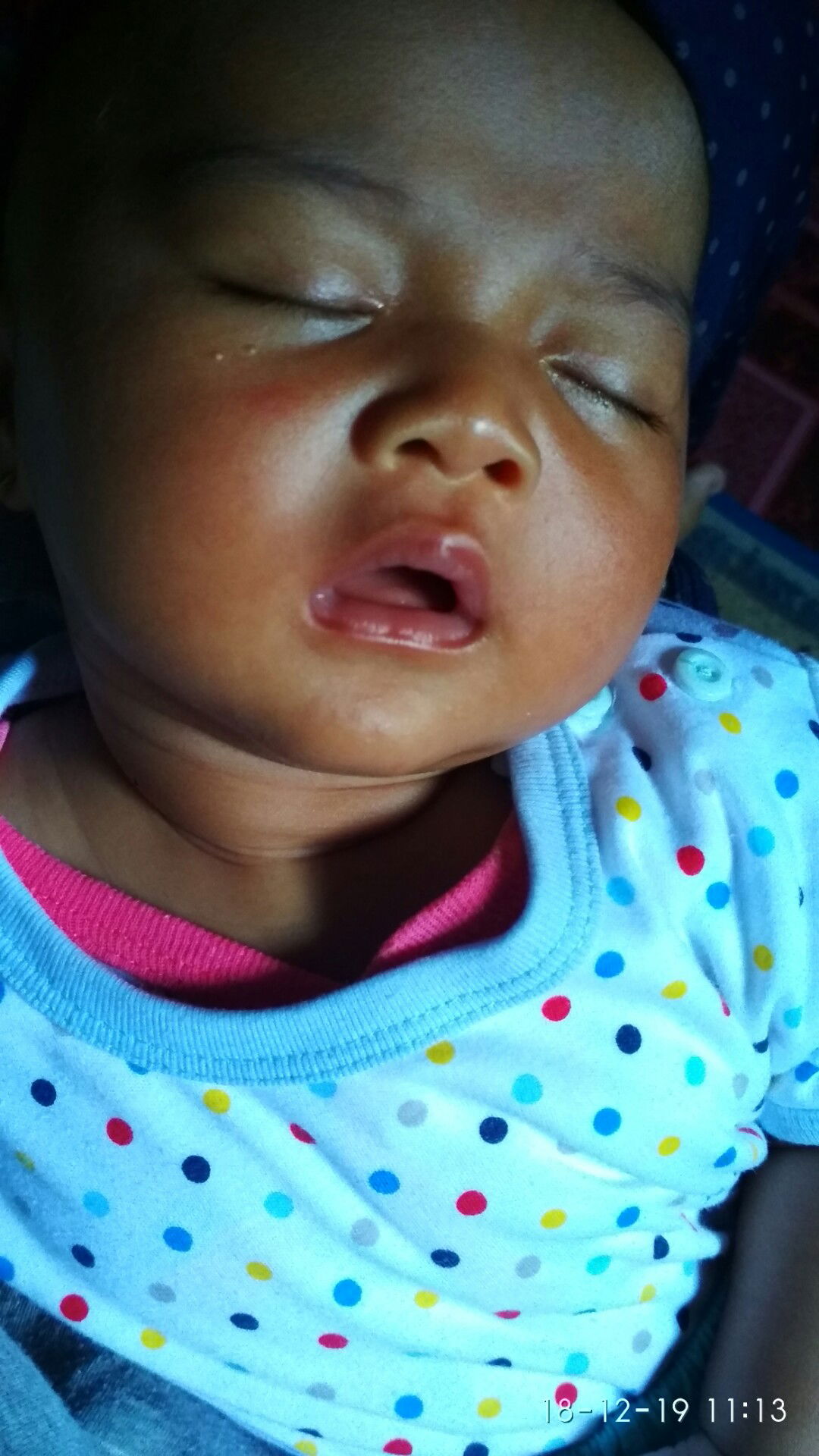 flu batuk pada bayi