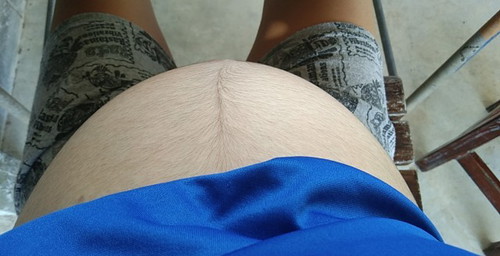 ผ้าอนามัย