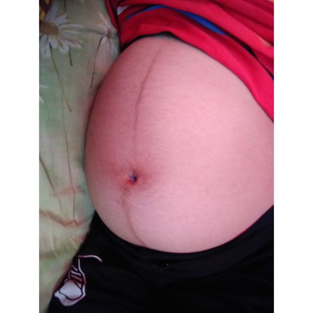 น้ำตาลในเลือดต่ำ