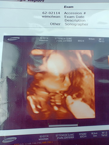 ดั้งมาเต็มเลยค่ะลูกสาว ทีม ก.ค ??