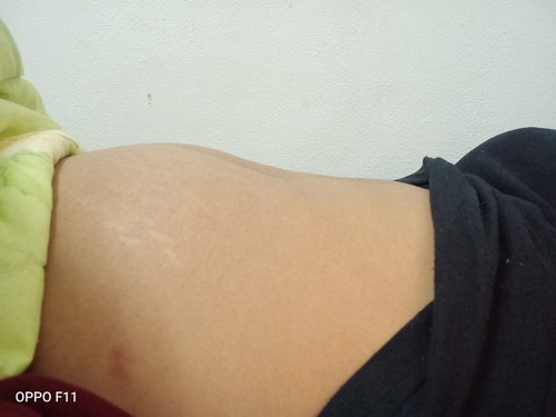 แบบนี้ผิดปกติไหมค่ะ