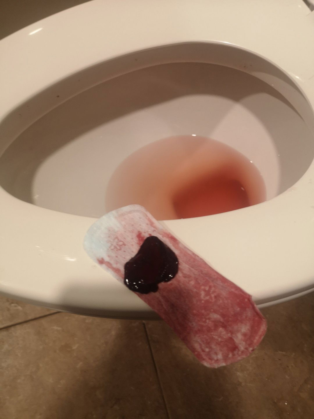 เลือดออกตอนท้อง11สัปดาห์​5วัน