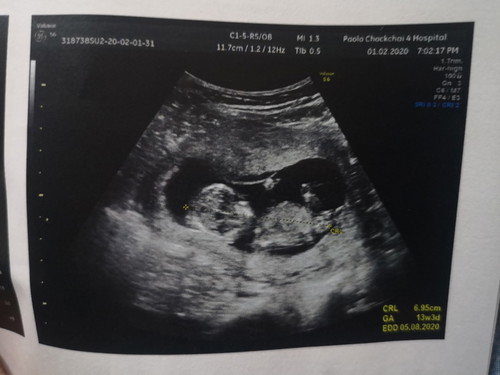 อัพเดทเเท้งคุกคาม 13W5D