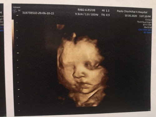 32week3day