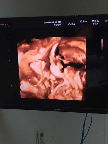 อยากรู้เรื่องอัลติาซาวแบบ4มิติ