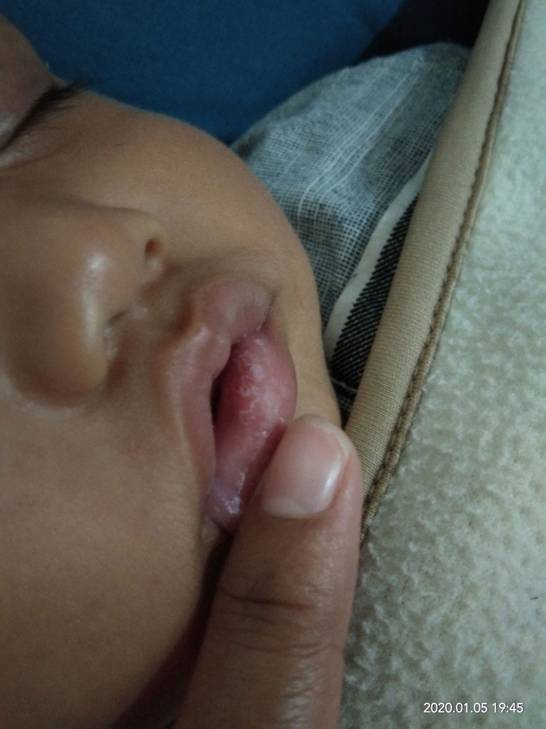 Dinding Mulut Bayi bagian dalam putih2..