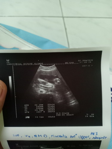 31w4d