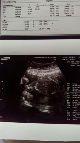 ทายให้หน่อย