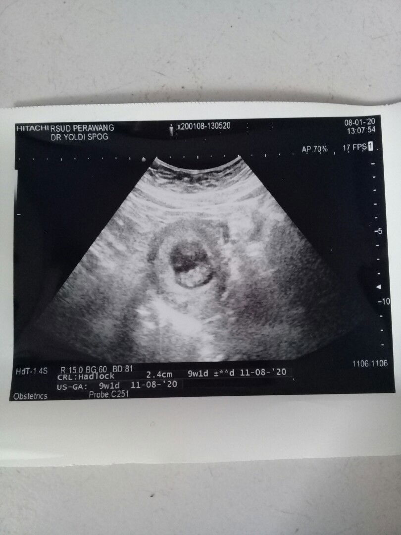 Khilyatul Aulia profile icon